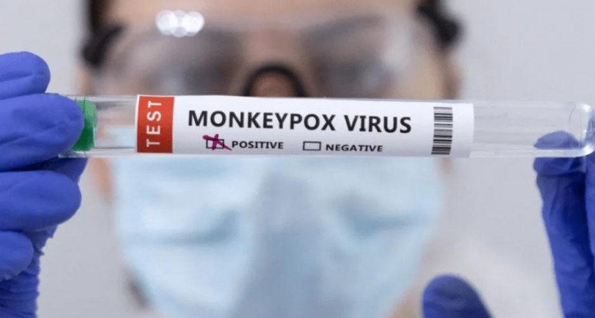 Contabilizan en todo el mundo más de 200 casos de viruela del mono